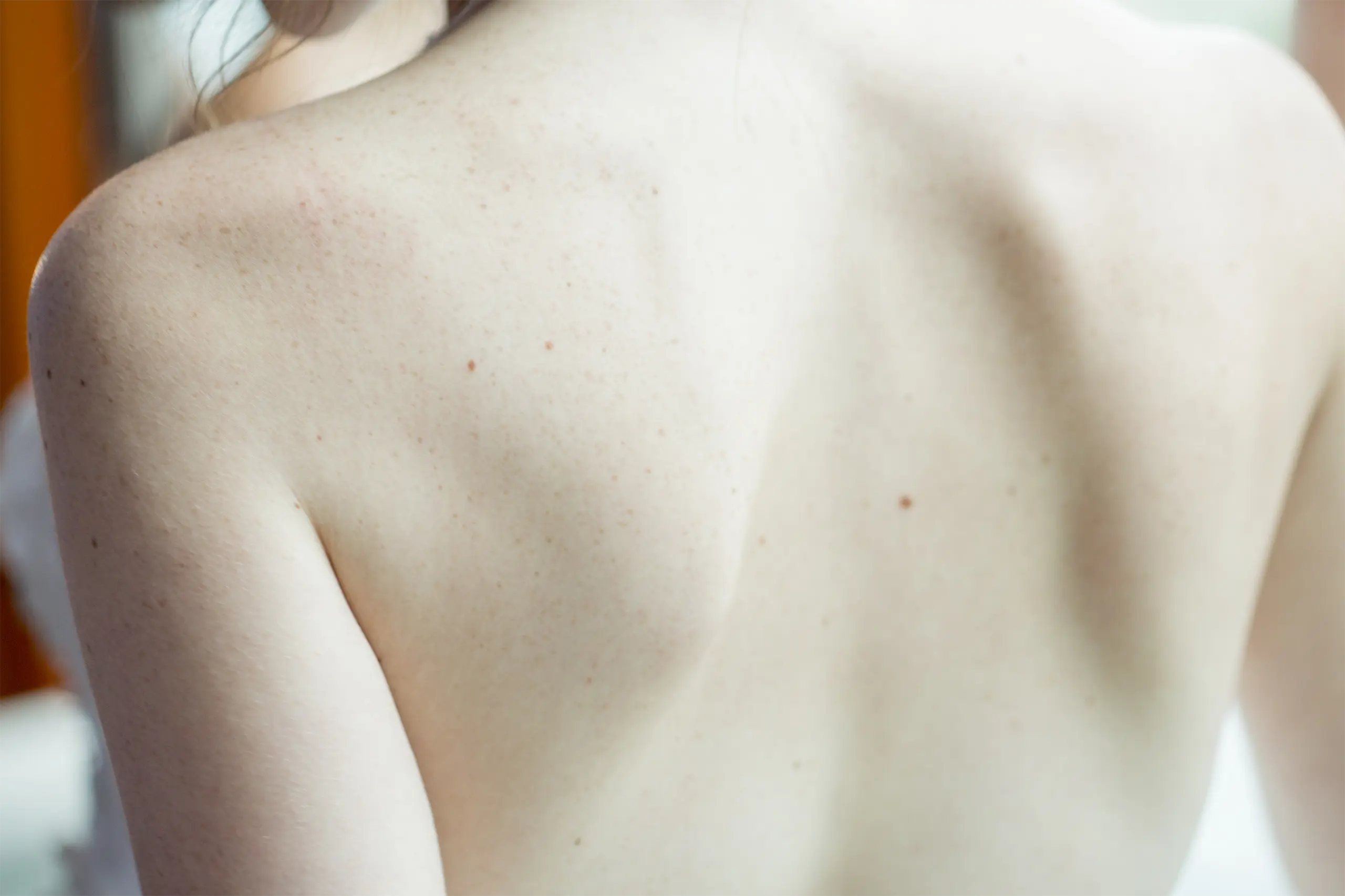 Os Benefícios da Dermatologia Estética para o Envelhecimento da Pele